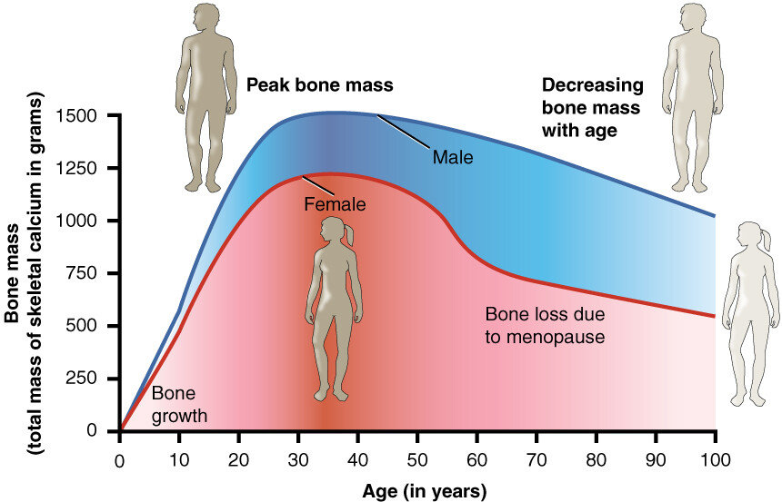 As we age, bone mass declines to make injuries from falls more likely. Dr. Douglas Kiburz of Bothwell Orthopedics & Sports Medicine recommends limiting the use of caffeine and nicotine in products, moderating alcohol consumption, getting regular exercise, as well as proper nutrition, including accurate supplementation of calcium and vitamin D as essential factors in maintaining healthy bone structure.